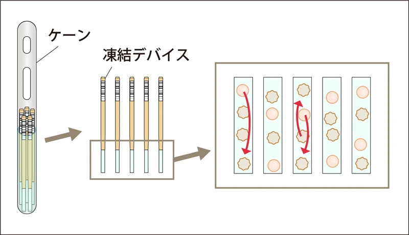 一般的な卵子凍結【複数個保存】